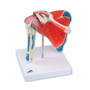 Schultergelenk mit Rotatorenmanschette,5-teilig